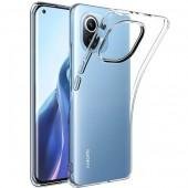 Чехол Ultra-thin 0.3 Xiaomi Mi 11 Lite White